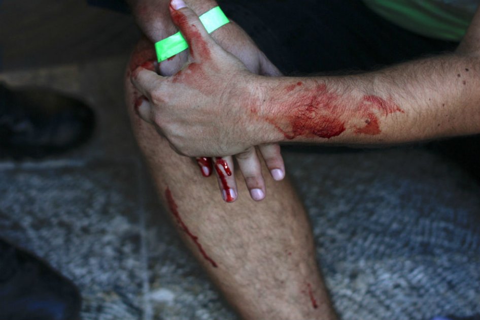 Seis personas heridas con arma blanca en marcha de orgullo gay en Jerusalén