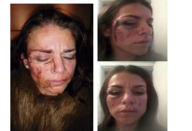 María Covaleda, quien sufrió maltrato, está siendo revictimizada: Defensoría