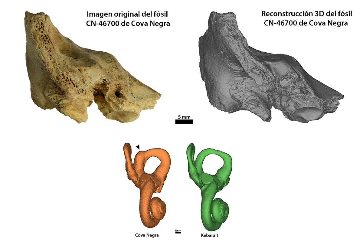 Arriba: Hueso temporal original y reconstrucción 3D del fósil CN-46700 de Cova Negra en vista anterior.
Abajo: Modelos 3D del oído interno de Cova Negra mostrando la dilatación patológica del canal semicircular anterior comparado con Kebara 1, un neandertal que no presenta la patología.
