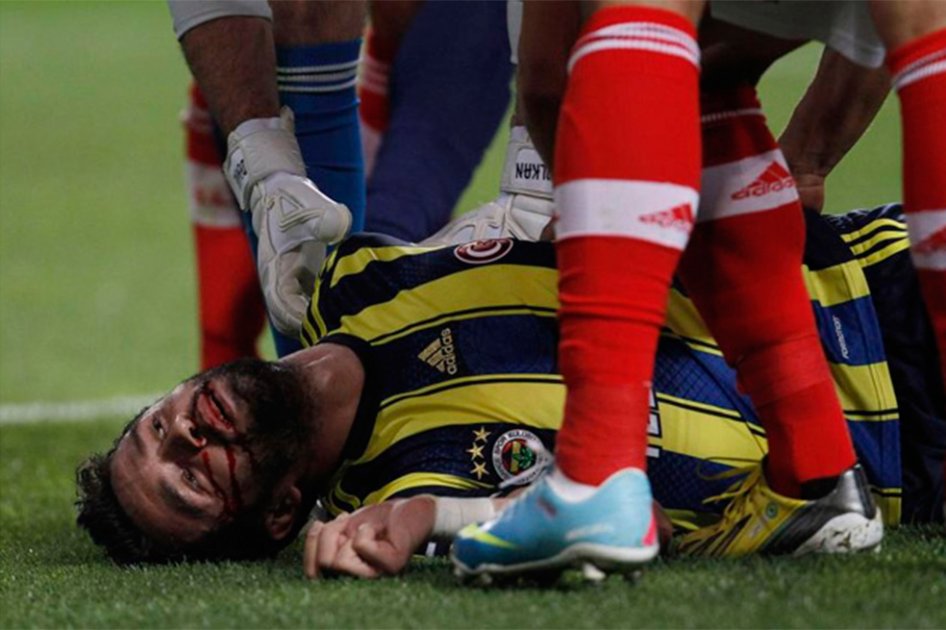 Con esta patada le rompieron la cara a un jugador del Fenerbahce