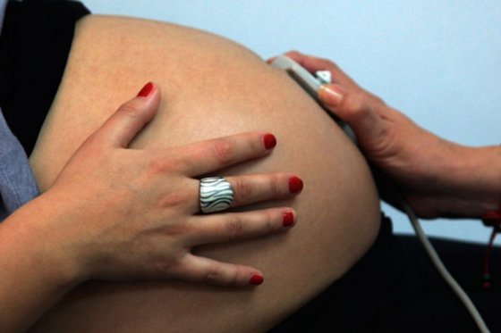 Lista de posibles defectos de nacimiento por Zika se hace más larga