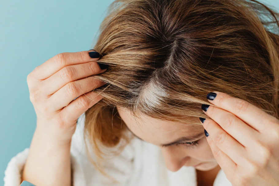 Canas: esta es la vitamina que te ayudaría a prevenirlas