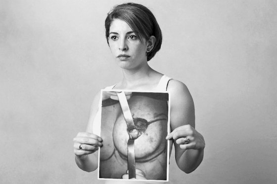 Liliana Fragoso
38 años
Lugar: Bogotá
Cirujano: Francisco Sales Puccini