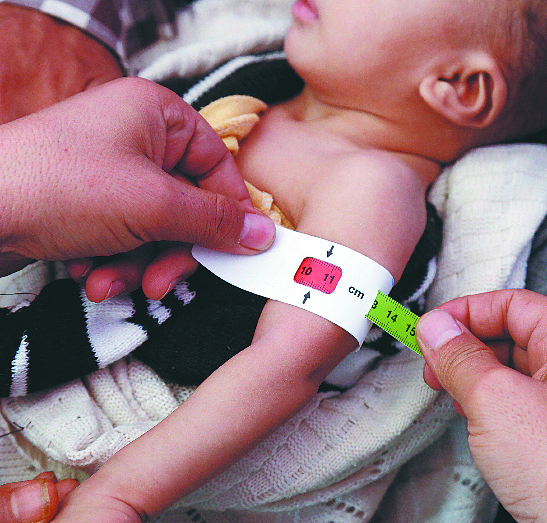 Más del 55% de la población mundial no tiene cubierto su derecho a la salud