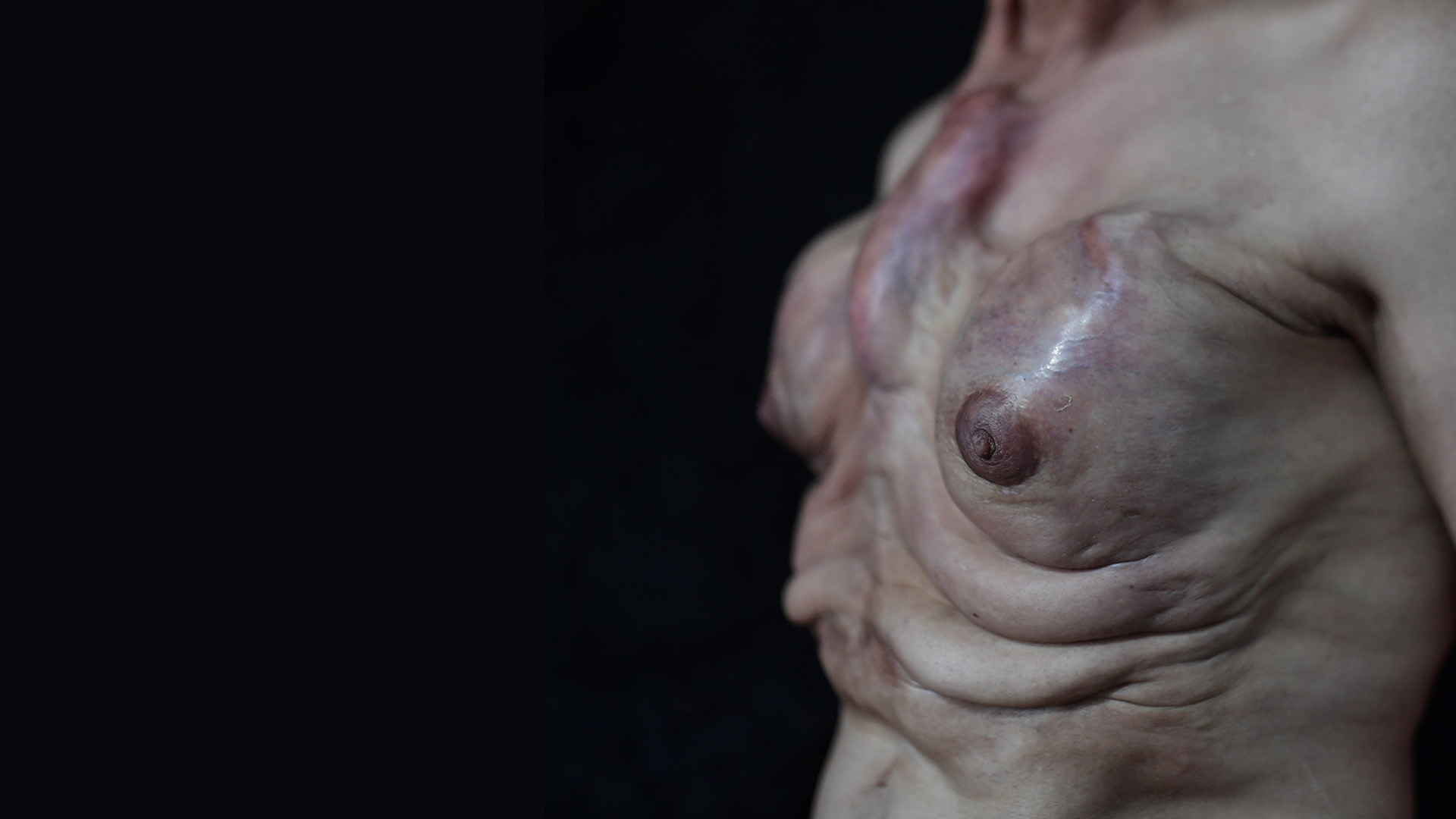 Los relatos de mujeres trans víctimas de biopolímeros