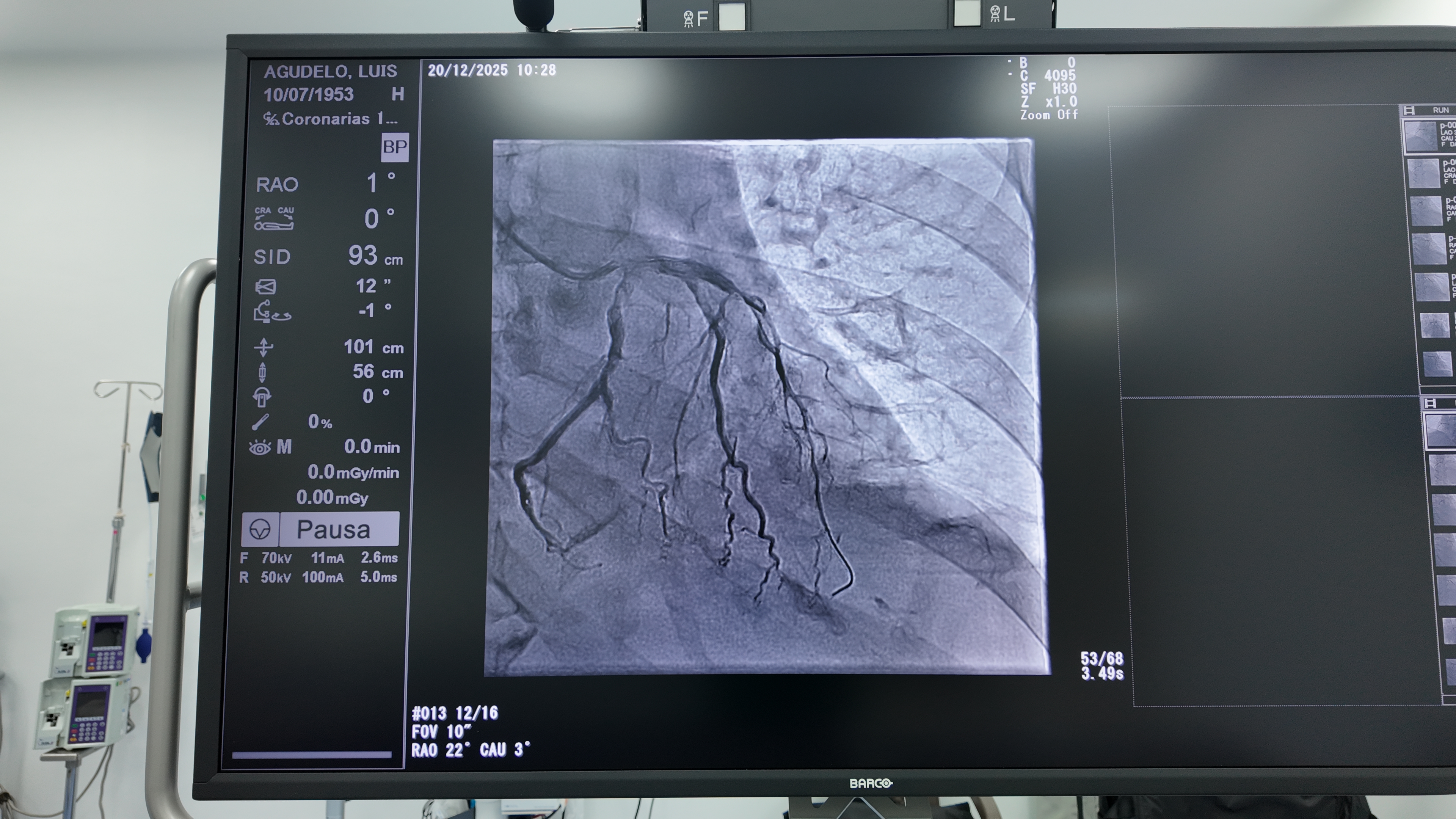 Primer angiógrafo de alta tecnología para la salud pública capitalina.