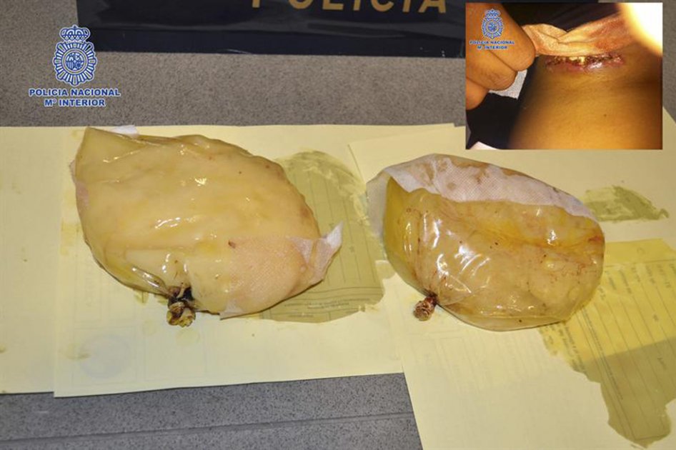 Pasajera portaba cocaína en sus prótesis mamarias
