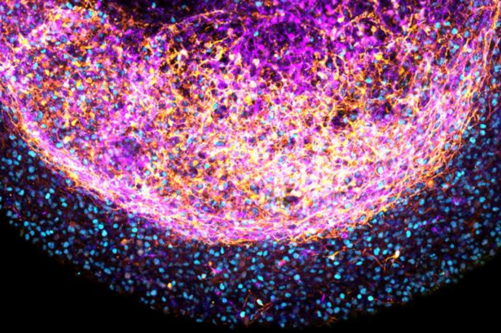 Por primera vez, crean “minicerebros” a partir del tejido cerebral de un feto humano