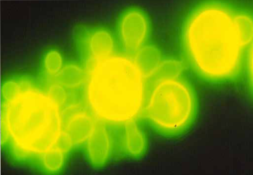 El Paracoccidioides spp. en su fase de levadura. Fotografía tomada con microscopio de fluorescencia.