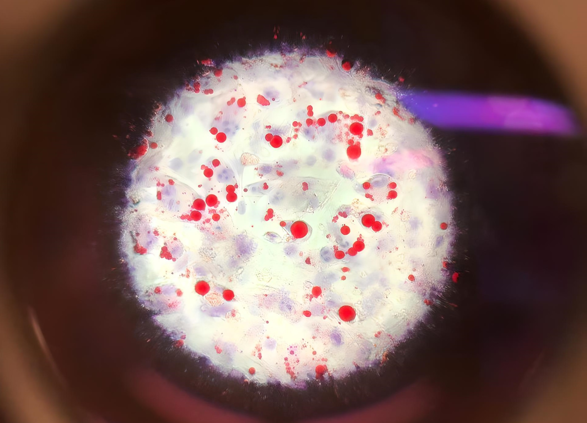Células de fibroblastos de ratón tomadas en Vidarium, que servían a los investigadores como punto de partida para experimentos en los que estudiaban el comportamiento de las células grasas.
