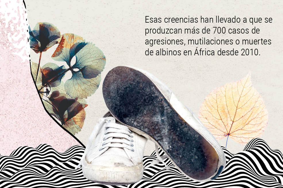 La “maldición” de ser albino en África: ¿por qué los quieren matar?