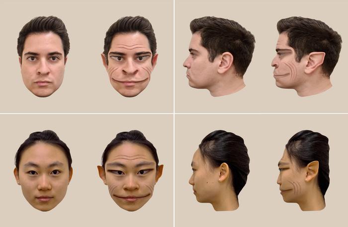 Así verían las caras las personas con esta extraña condición de salud