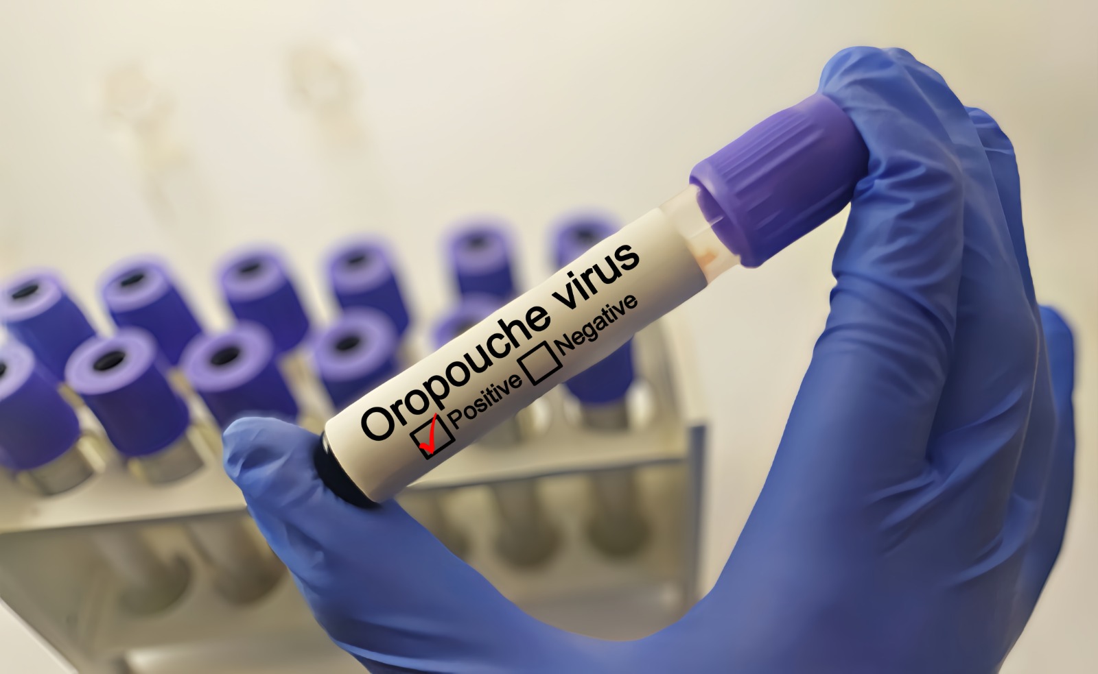 Oropouche, otro virus que no hay que perder de vista: hay aún muchas inquietudes
