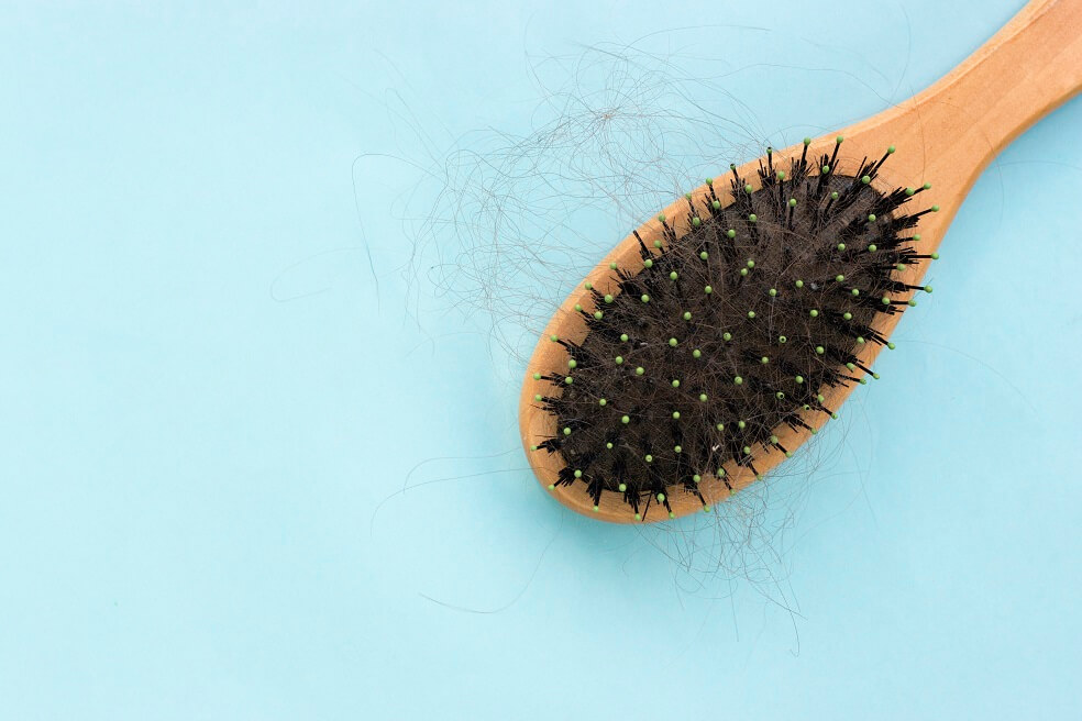 Pérdida de pelo en hombres y mujeres: síntomas y causas