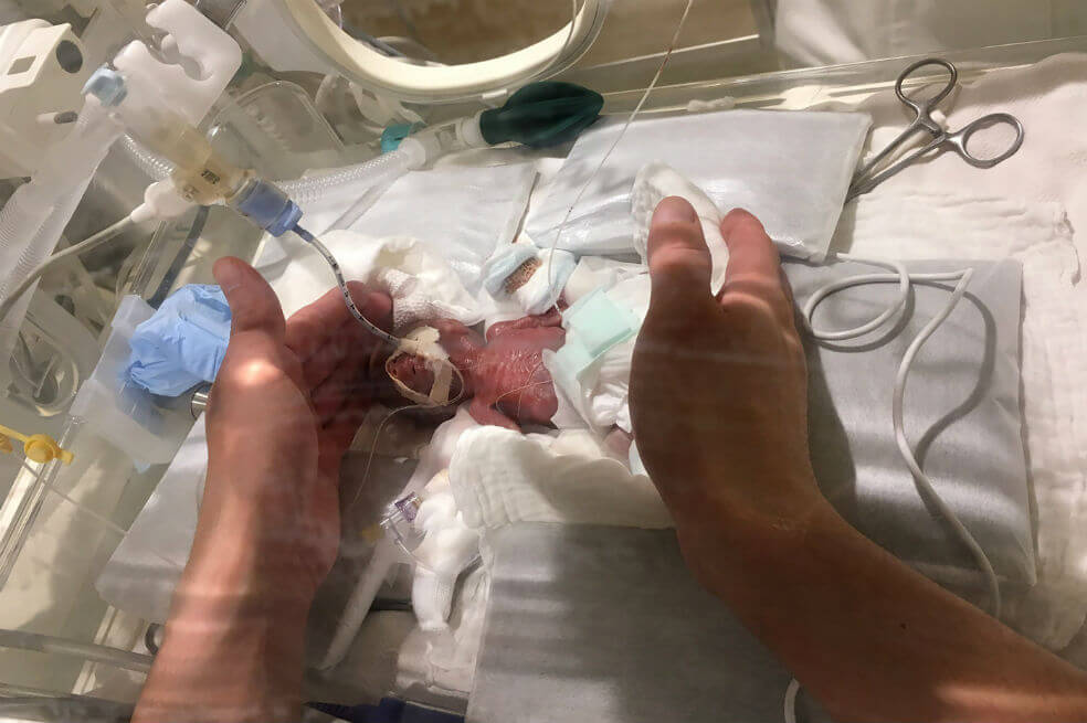 Dan de alta en Japón al bebé más pequeño del mundo