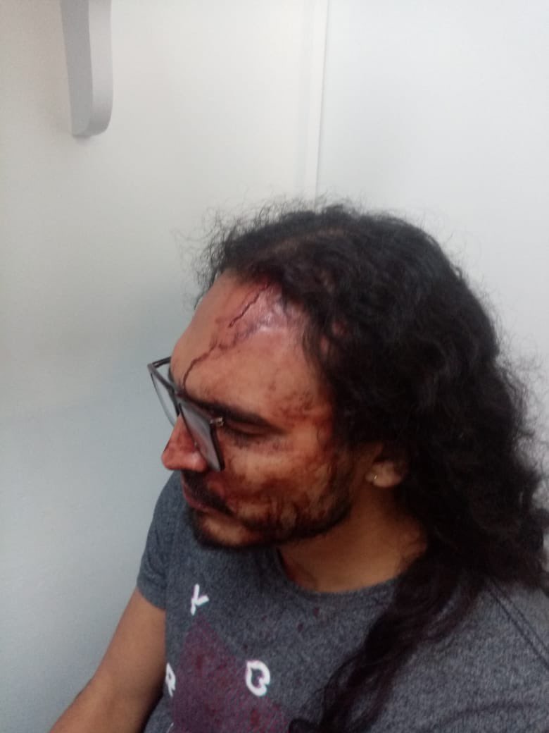“La sangre no me dejaba abrir el ojo”:relato de un nuevo abuso policial en Bogotá
