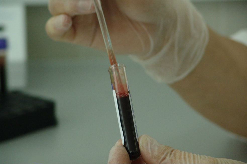 Desarrollan un prometedor antiviral contra el virus del sida