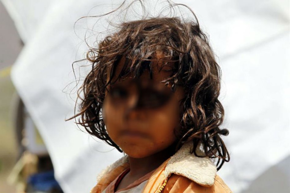 Otro niño víctima del conflicto en Yemen: murió en Arabia Saudí por impacto de misil