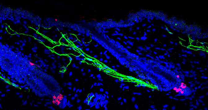 Inervación simpática (verde) alrededor de las células madre de los melanocitos (rojo).Bing Zhang y Ya-Chieh HsuCómo el estrés influye en nuestro cuerpoLos autores consideran que el estrés activa el sistema nervioso simpático, induciendo la liberación de un neurotransmisor –llamado noradrenalina– que hace que las células madre de los melanocitos, es decir las que dan color al cabello, se activen excesivamente.