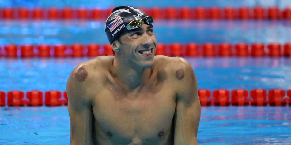 ‘Cupping’, la terapia detrás de los moretones de Michael Phelps en la espalda