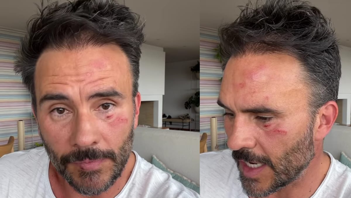 Capturados presuntos responsables del atraco a Juan Pablo Raba en los Cerros Orientales