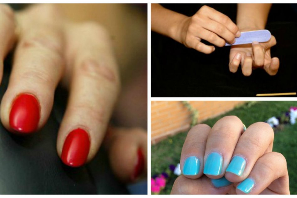 Comerse las uñas, un problema de salud, de estética y psicológico