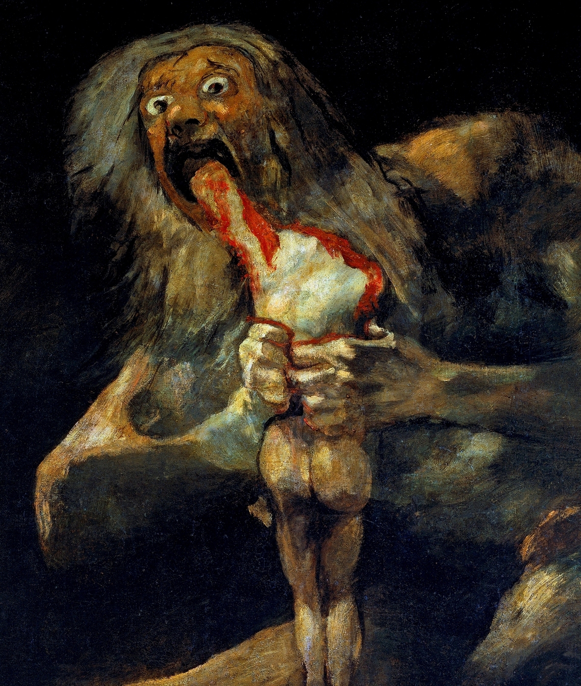 ¿Una enfermedad autoinmune detrás del arte de Goya?