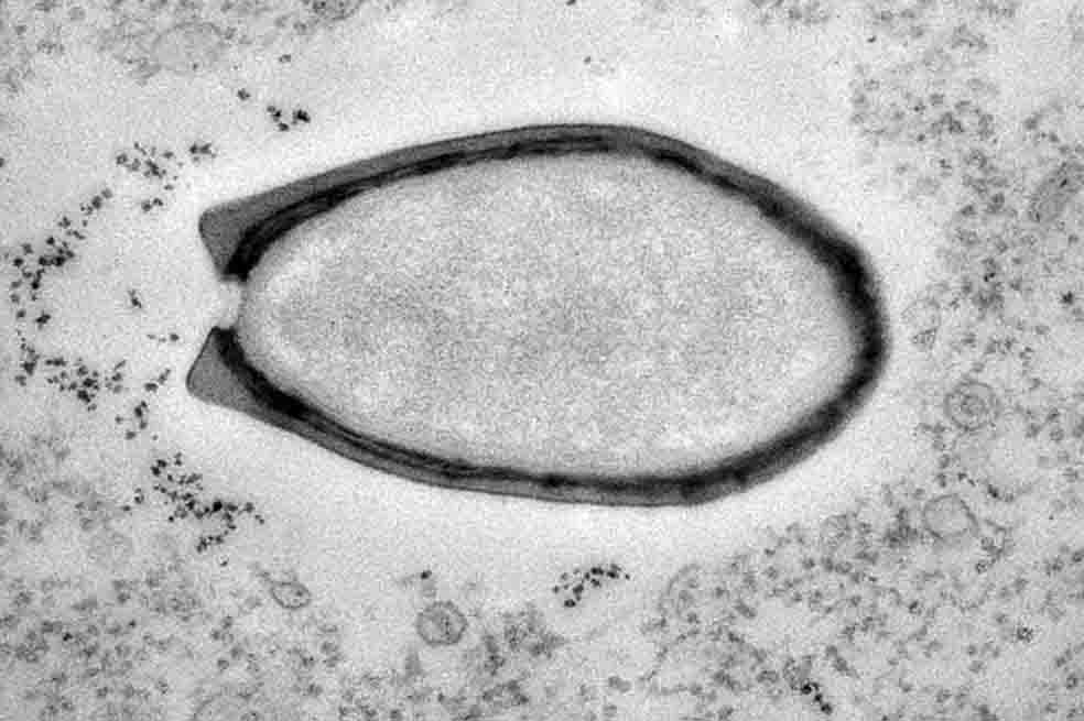 El virus más grande del mundo