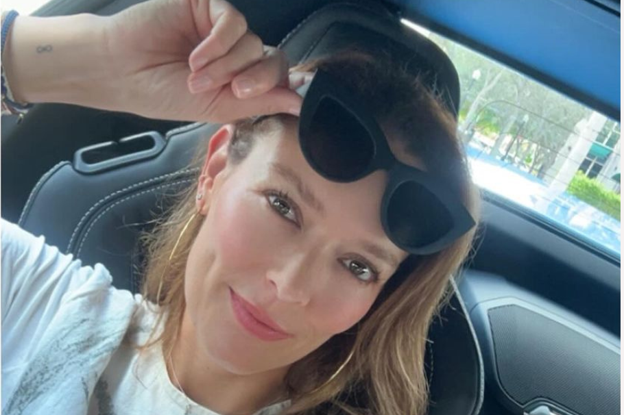 Carolina Acevedo reveló que padece de extraña afección en su rostro