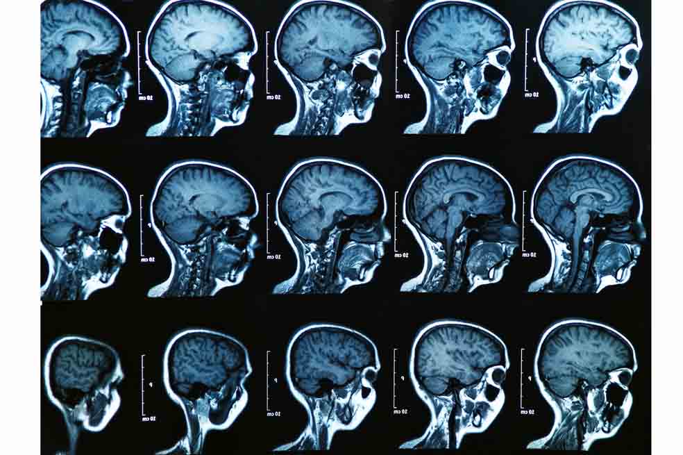 ¿Qué le ocurre a tu cerebro cuando te quedan 30 minutos de vida?