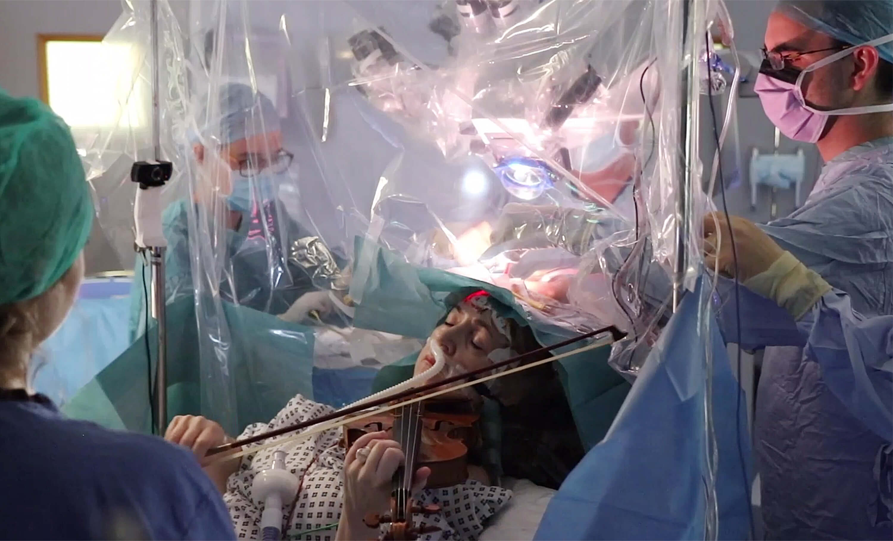 Una mujer tocó el violín mientras le extirpaban un tumor cerebral