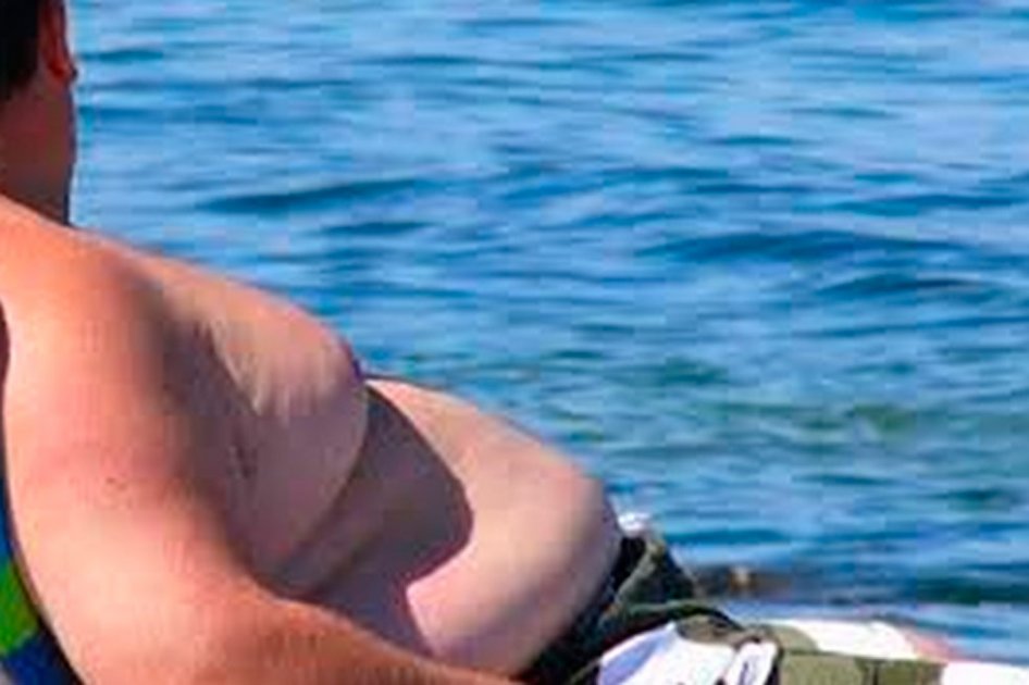 ¿Se puede heredar la obesidad?
