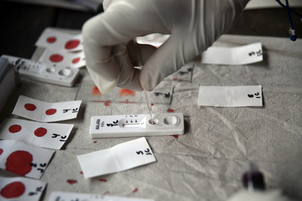 Las muestras de sangre que encontraron los investigadores en Guapi parecen indicar que en la región ya habría aparecido la resistencia a la artemisinina. Sin embargo, todavía es muy pronto para hacer una afirmación con total certeza.Óscar Pérez – El EspectadorCuando sus aliados del Instituto Sanger, en Reino Unido, le enviaron el mapa genético de los parásitos, Corredor no esperó un segundo para revisar los resultados. En enormes bases de datos colaborativas sobre el genoma de la malaria -algo así como un Wikipedia sobre mutaciones genéticas de la malaria- comparó los mapas que habían descubierto en Guapi con las plantillas genéticas del parásito de malaria Plasmodium falciparum.