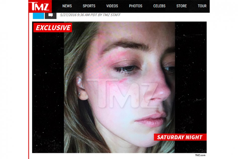 Amber Heard acusa a Johnny Depp de golpearla con un «iPhone en el rostro»