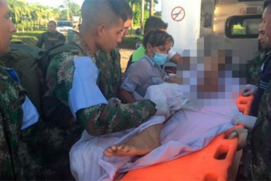Menor resultó herido por mina antipersonal instalada por Farc en Putumayo