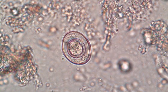 Imagen de “Hymenolepis nana”, parásito que transmitió el cáncer. / Archivo particular