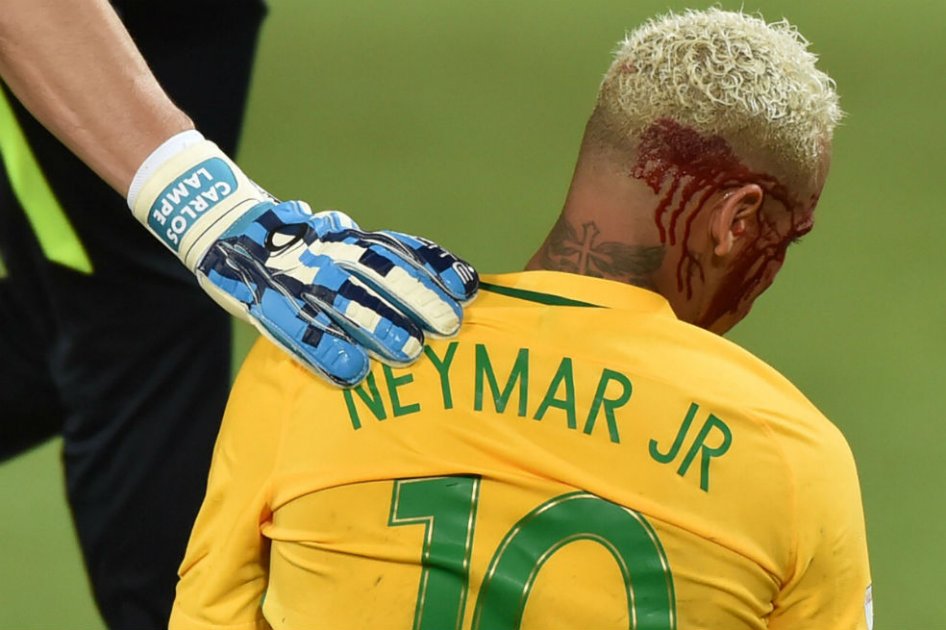 La sangre de Neymar tras recibir un fuerte codazo