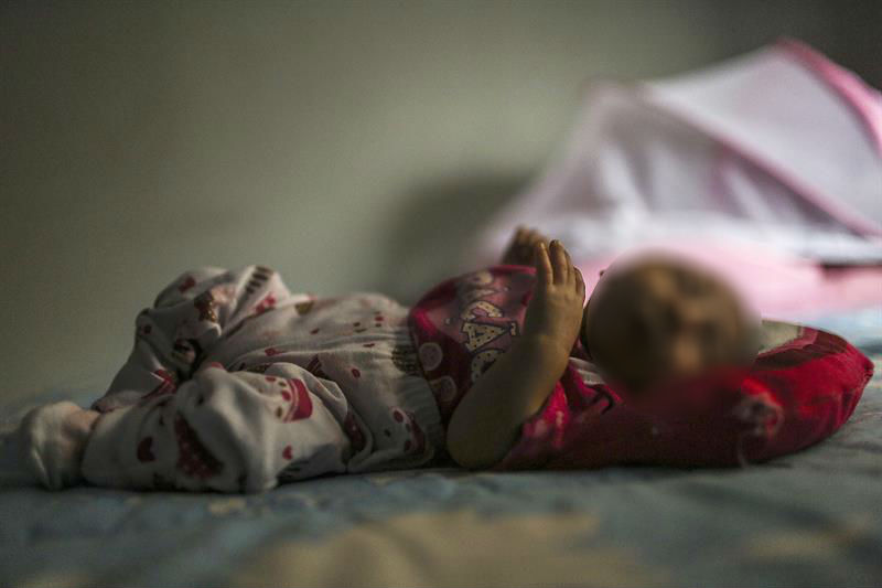 Encuentran virus del zika en cerebros de bebés