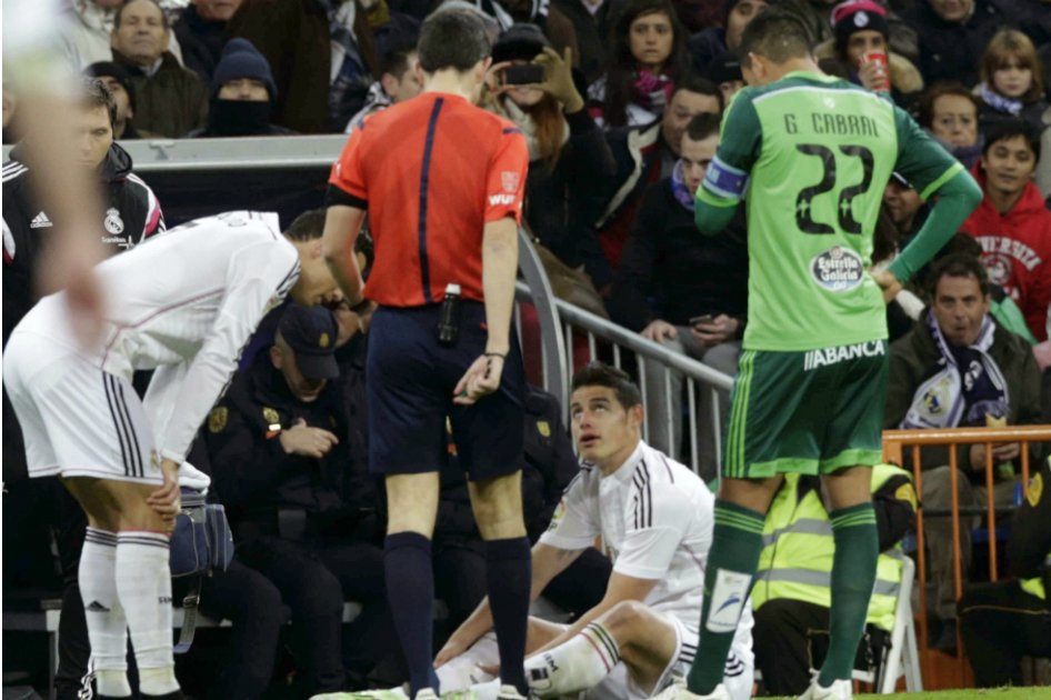 James sufrió una lesión en el gemelo derecho: Ancelotti