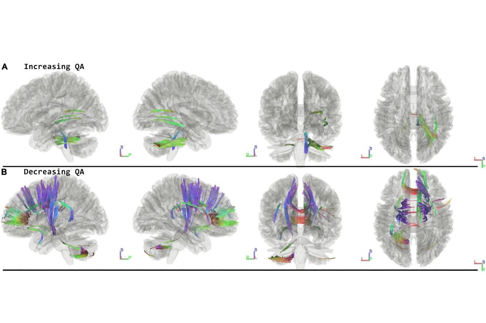 ¿Qué le pasa al cerebro luego de estar mucho tiempo en el espacio? La ciencia responde