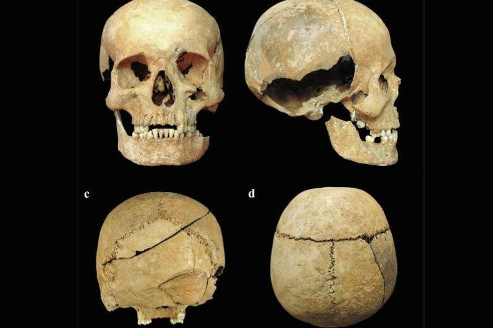 Así se ve el cráneo de un joven que murió por varios golpes de espada hace 700 años