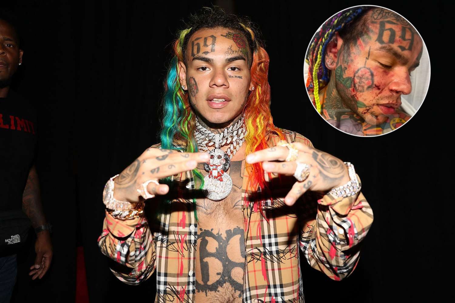 Rapero 6ix9ine, en urgencias tras recibir fuerte golpiza en un gimnasio de Miami