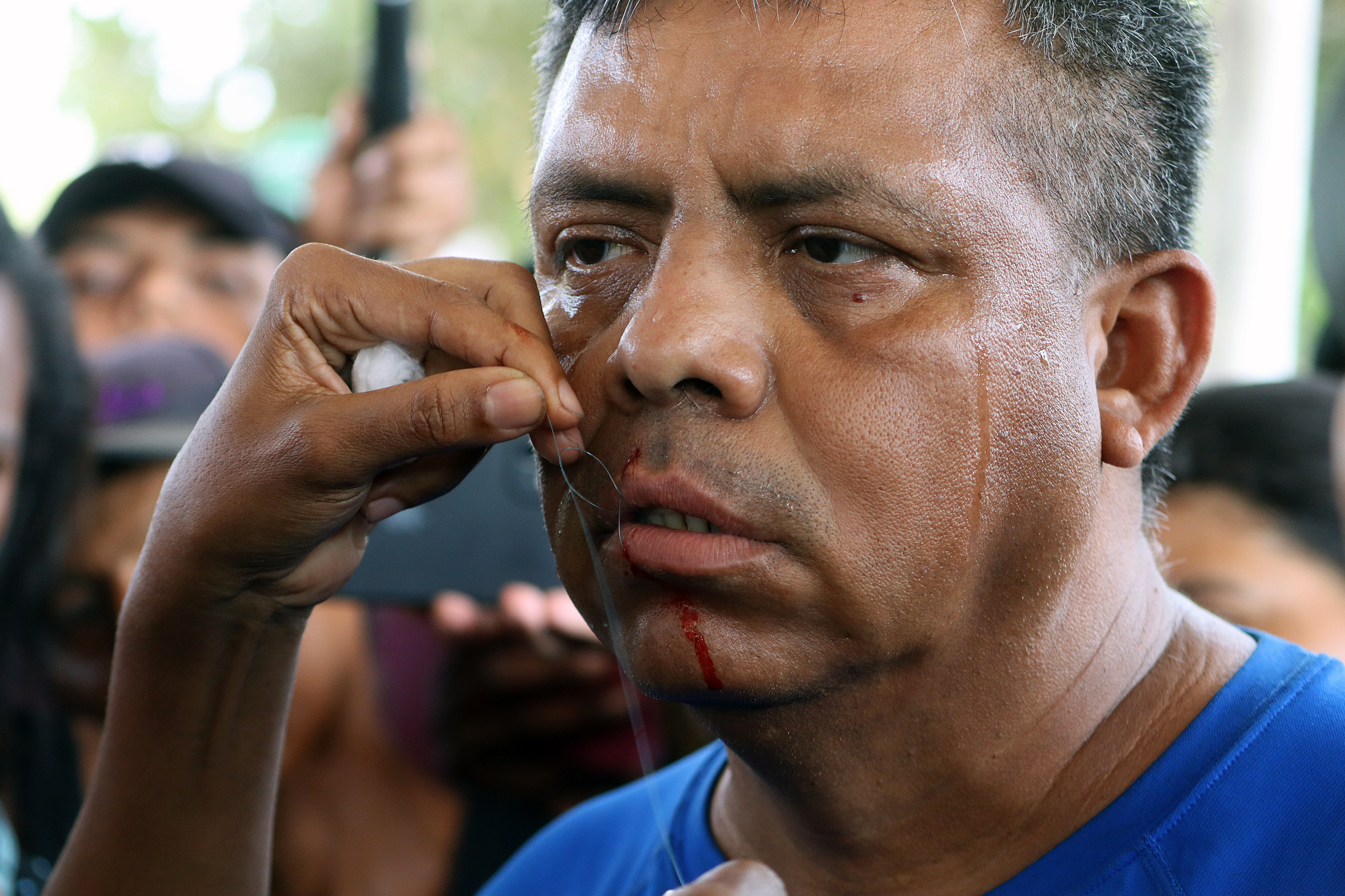 Migrantes protestan contra autoridades mexicanas suturándose los labios