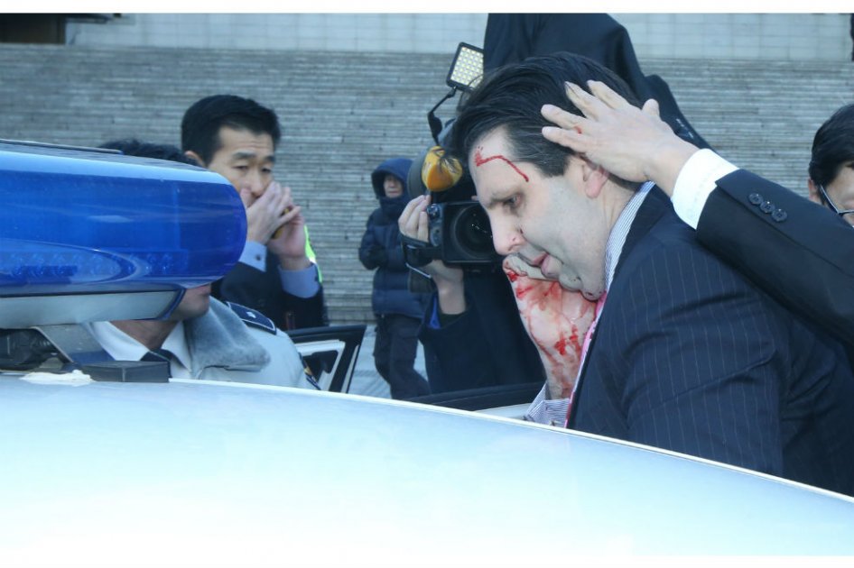 Herido el embajador de EE.UU. en Corea del Sur por un hombre armado