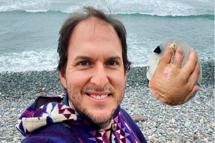 Andrés Parra: así se está recuperando el actor de un grave accidente que sufrió