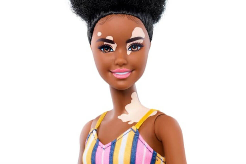 Barbie lanza muñecas con vitiligo y sin pelo para apostarle a la diversidad