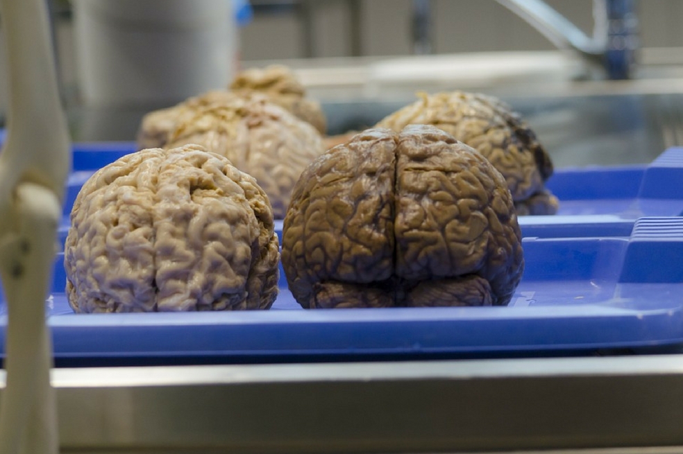Mejoran la capacidad de memoria en los humanos con un implante cerebral