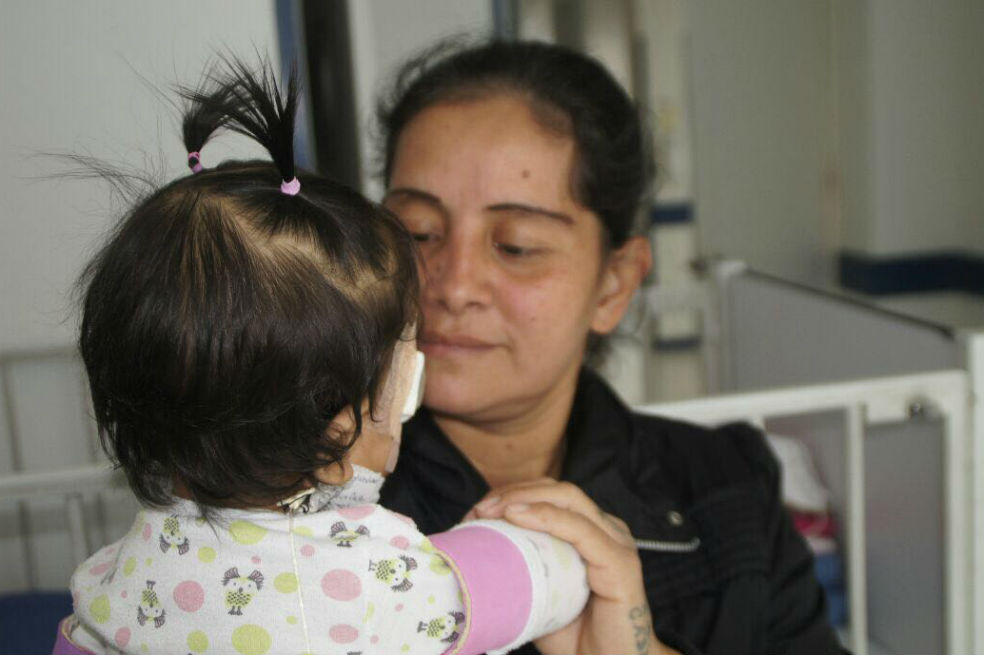 Salvan vida de bebé con malformación cráneo facial