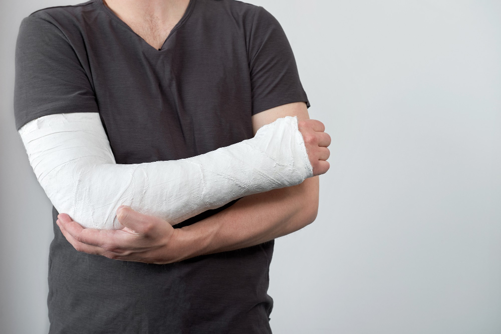 Soñar que me parto un brazo qué significa. ¿Augurio de mala o buena suerte?