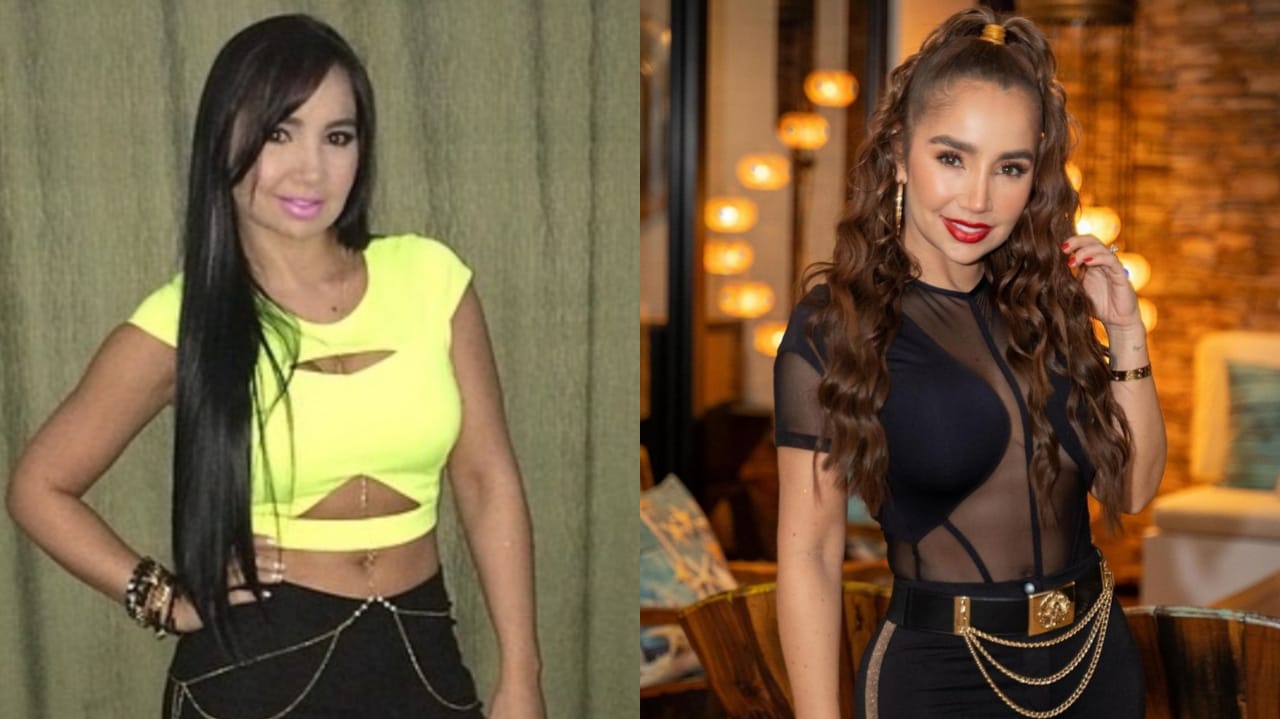 Paola Jara: Antes y después de sus cirugías